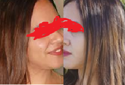 glutathione for skin whitening.png