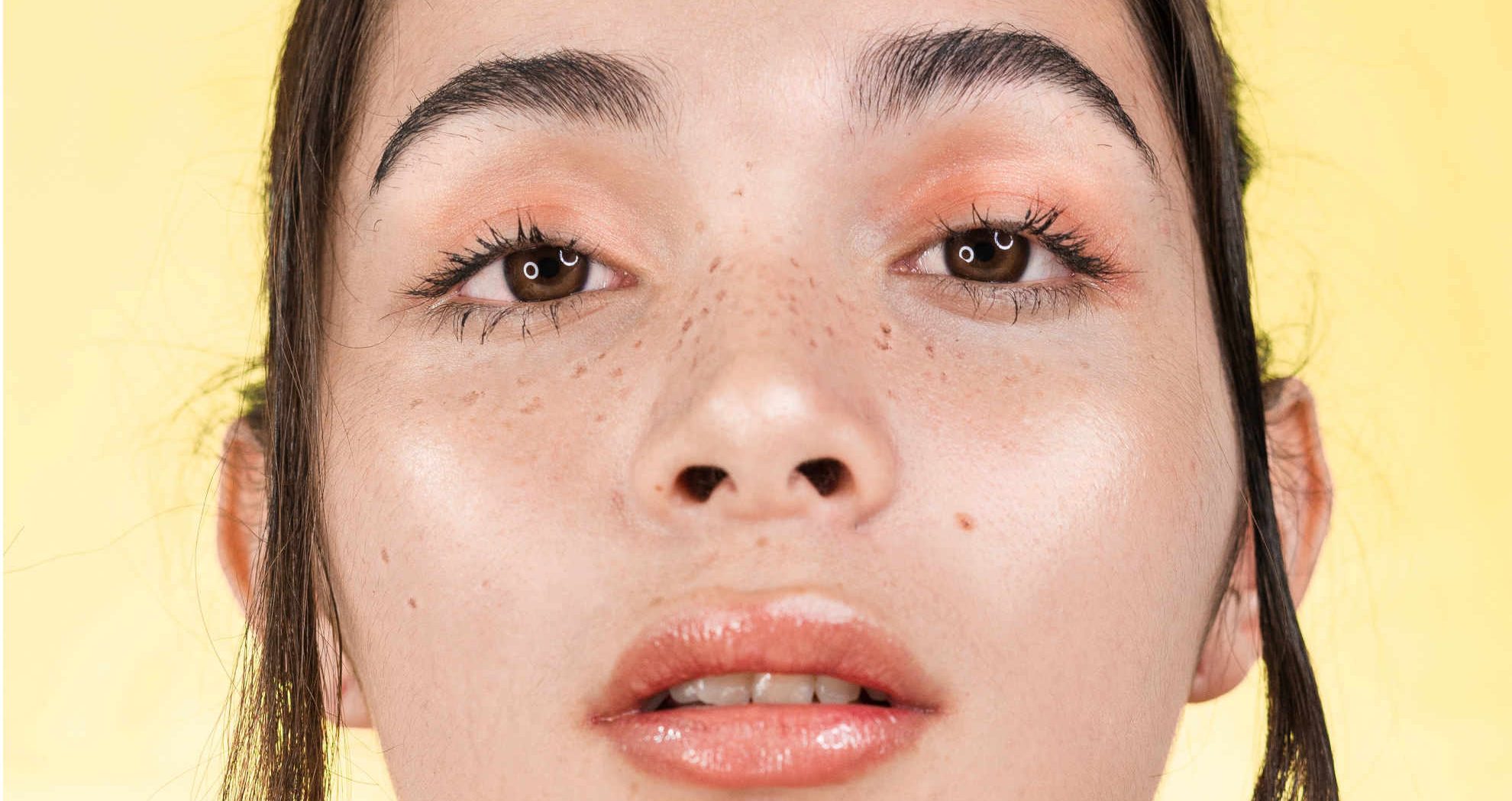 Dark Spots 8 Most Common Types Of Skin Blemishes SkinAlley dark-spots-8-most-common-types-of-skin-blemishes-skinalley